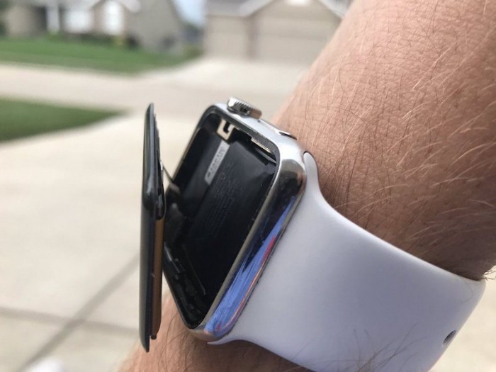 apple-watch-swollen-800x600.jpg