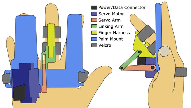 bird-parkinsons-finger-1.jpg