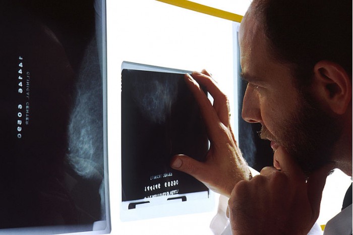 800px-Doctor_viewing_mammogram.jpg