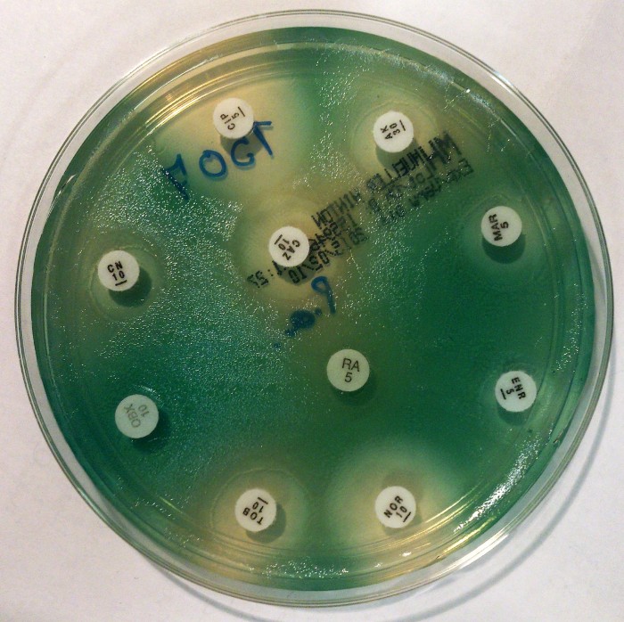 布莱恩特可能患有绿脓假单胞菌属感染,这种感染是由绿脓杆菌引起的,是
