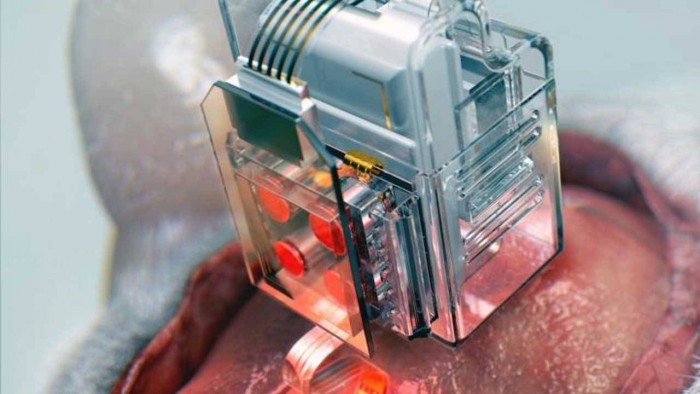 brain-implant-1280x720.jpg