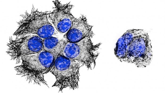 pancreatic-cancer-drug-1.jpg