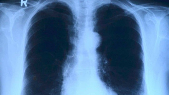 lungs-1280x720.jpg