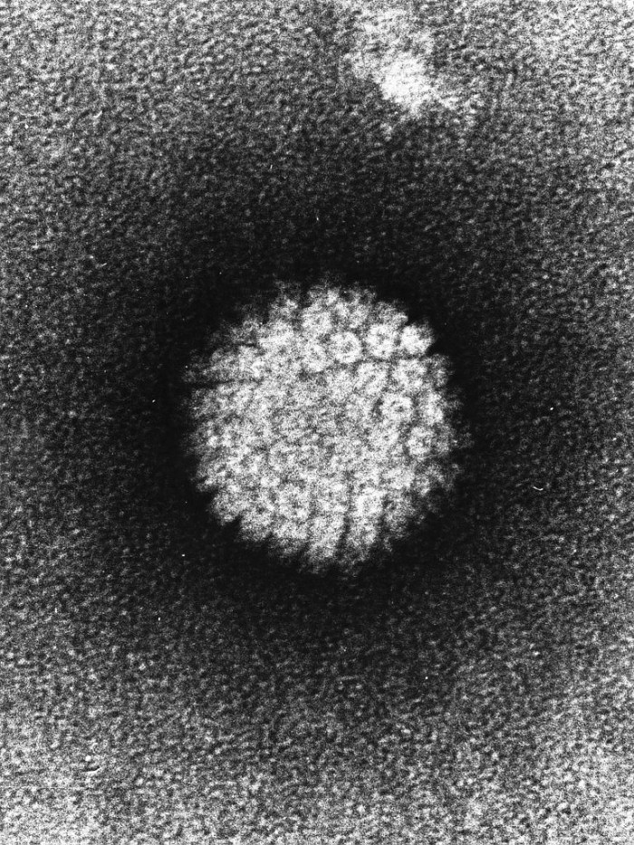 768px-Papilloma_virus_(hpv).jpg