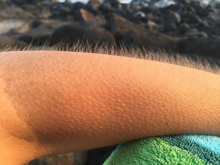 goosebumps-885563_960_720.jpg