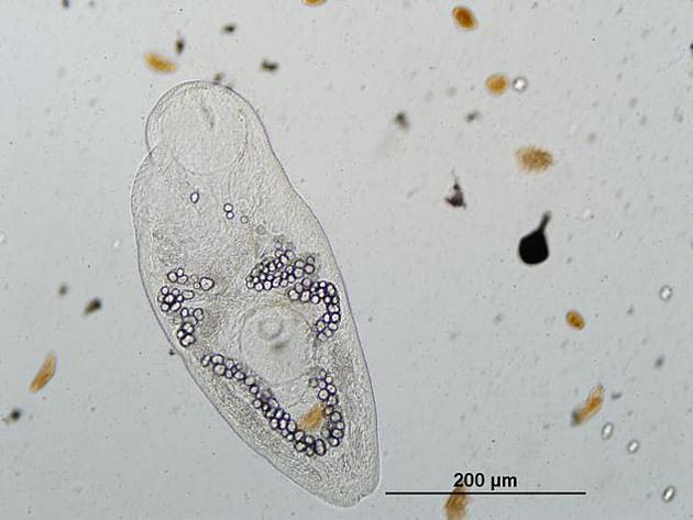 图为Ribeiroia ondatrae，是一种导致两栖动物肢体畸形的寄生虫。研究人员的保护计划中未收录任何可感染人类或家畜的寄生虫。