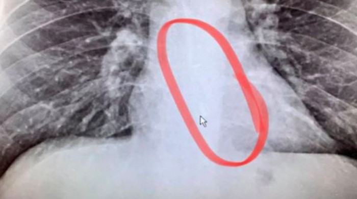 40170-77297-airpodxray-xl.jpg