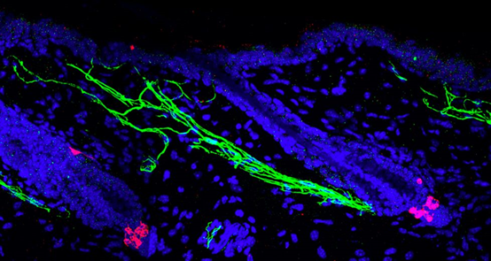 色素干细胞（红色）周围的复杂交感神经（绿色）。急性压力诱导交感神经系统过度活化，释放大量的神经递质去甲肾上腺素。去甲肾上腺素驱使黑素细胞干细胞快速耗竭并使头发灰白。