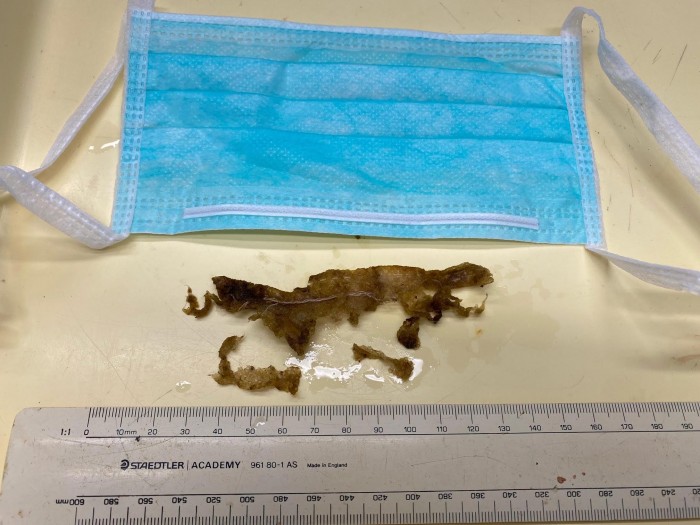 Stomach-Contents-of-Green-Sea-Turtle-Following-Necropsy.jpg