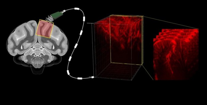 Ultrasound-Brain-Machine-Interface-777x394.jpg