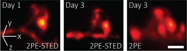 Imaging-Dendritic-Spines.jpg
