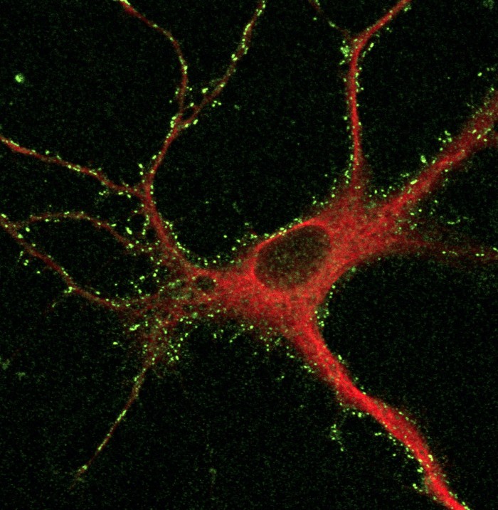 Cortical-Neurons-After-Two-Step-Labeling.jpg