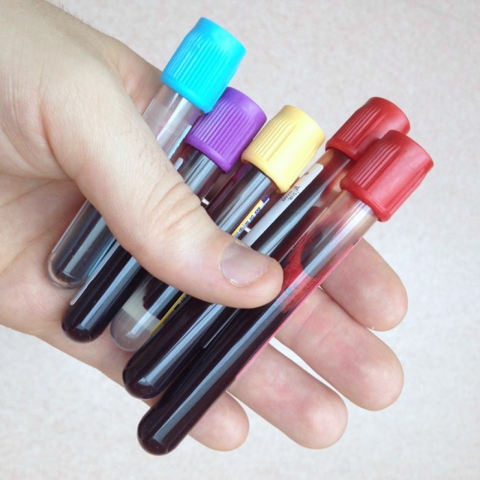 Vacutainer_blood_bottles.jpg