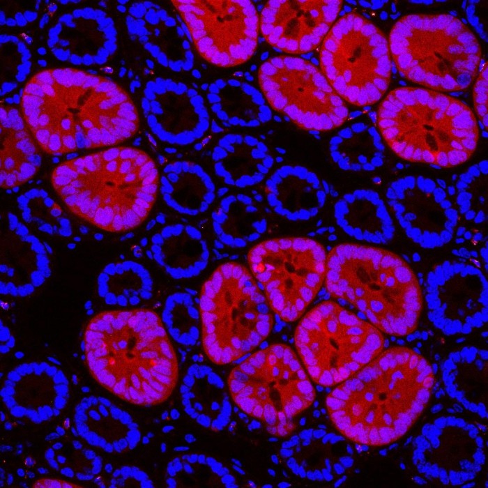 Red2Onco-Confocal-Micrograph.jpg