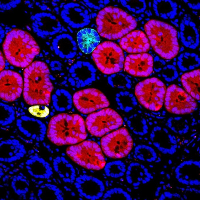Red2Onco-Confocal-Microscopy-777x777.jpg