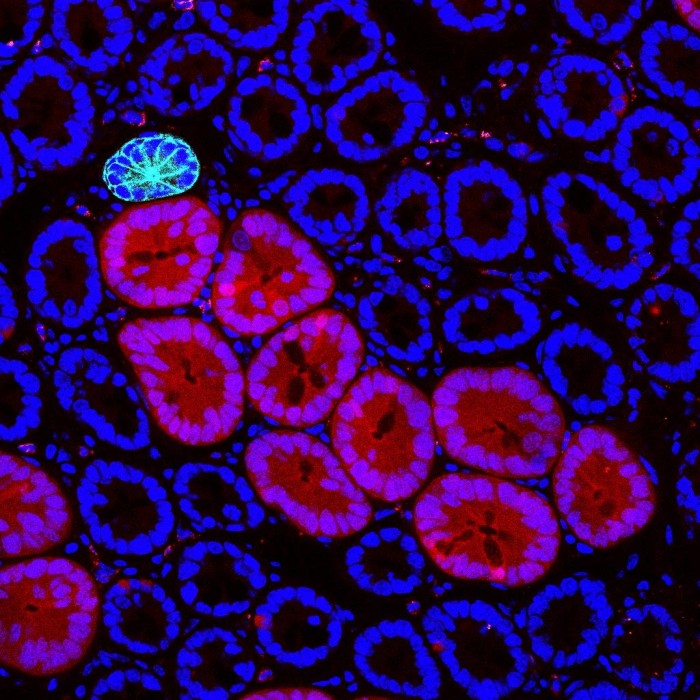Red2Onco-Confocal-Micrograph-Mouse-Intestine.jpg