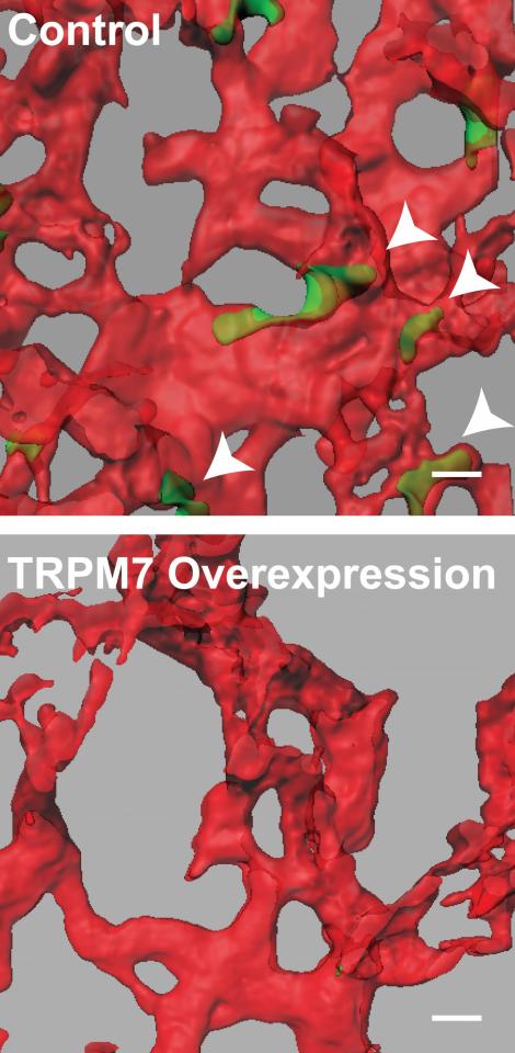 trpm7.jpg