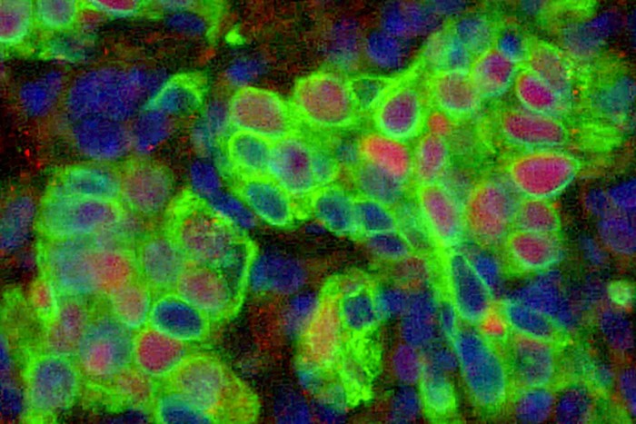 Basal-Epithelial-Stem-Cells-in-Lung.jpg