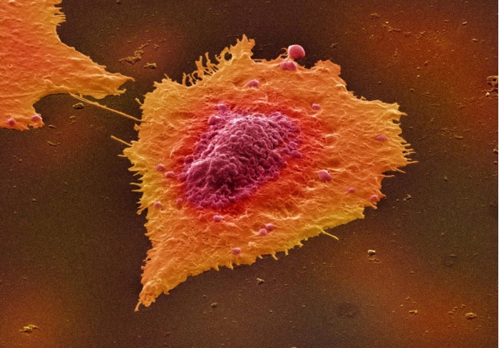 Human-Colon-Cancer-Cells.jpg