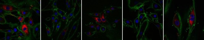 Reprogrammed-Cells-Produce-Collagen-768x152.jpg