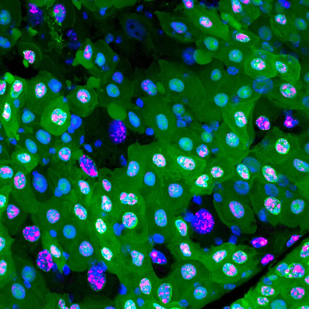 Gut-Cells-at-Different-Stages-of-Erebosis.webp