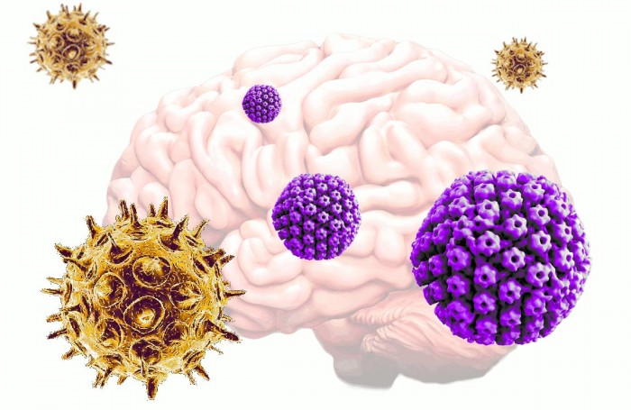 Varicella-Zoster-Herpes-Simplex-Virus-Alzheimers-Disease.jpg