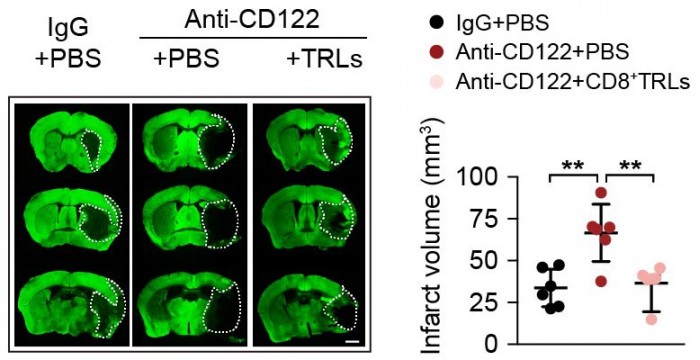 Brain-Regions-Affected-by-Ischemia-in-Stroke-Mice.jpg