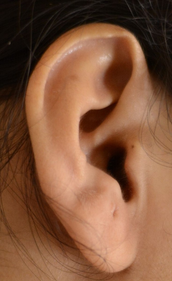 734px-Human_Ear.jpg