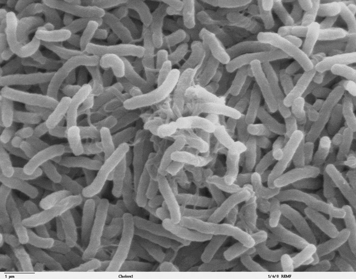 Cholera_bacteria_SEM.jpg