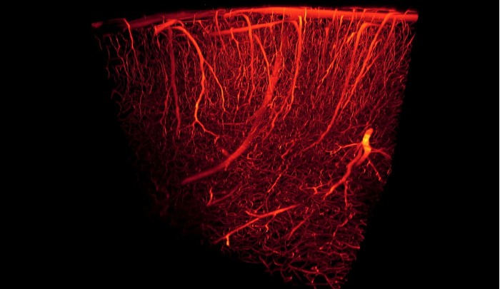 1599px-Blood_vessels-3D_rendering.jpg