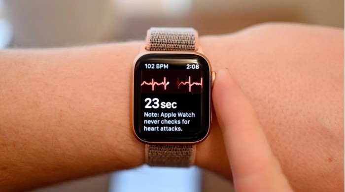 50121-98365-49883-97770-42988-83539-36855-68891-apple-watch-heart-ecg-xl-xl-xl-xl.jpg