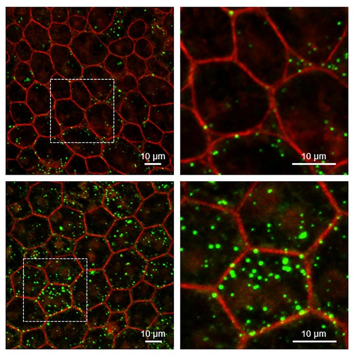 Serpin1-Lipid-scaled.jpg