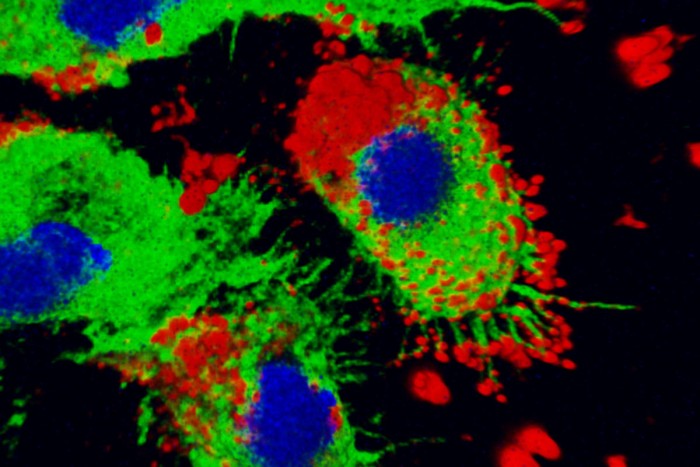 Macrophages-with-Nanoparticles.jpg