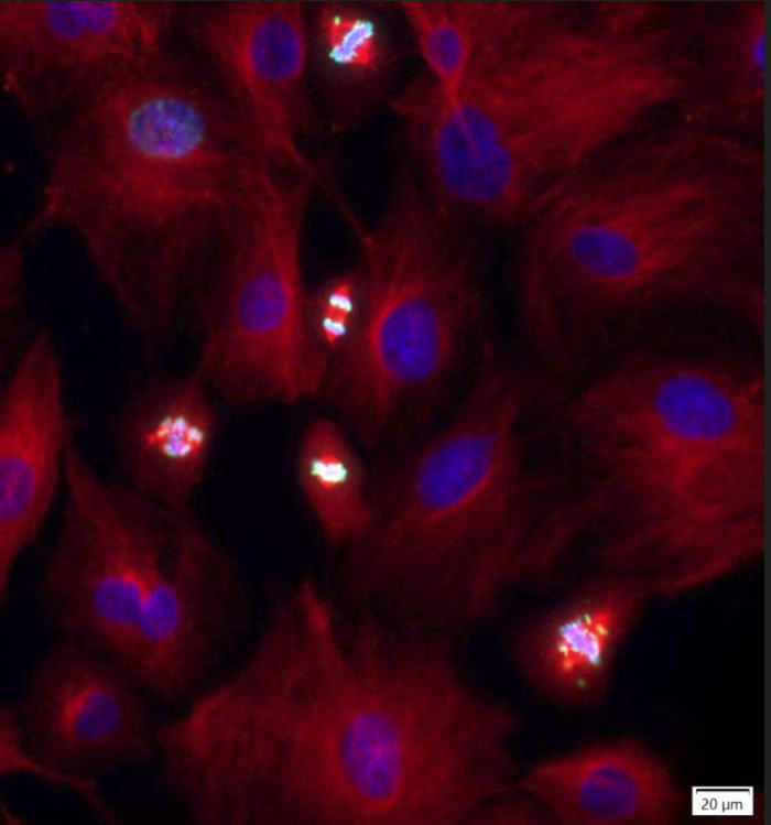 Chromosome-Segregation.jpg