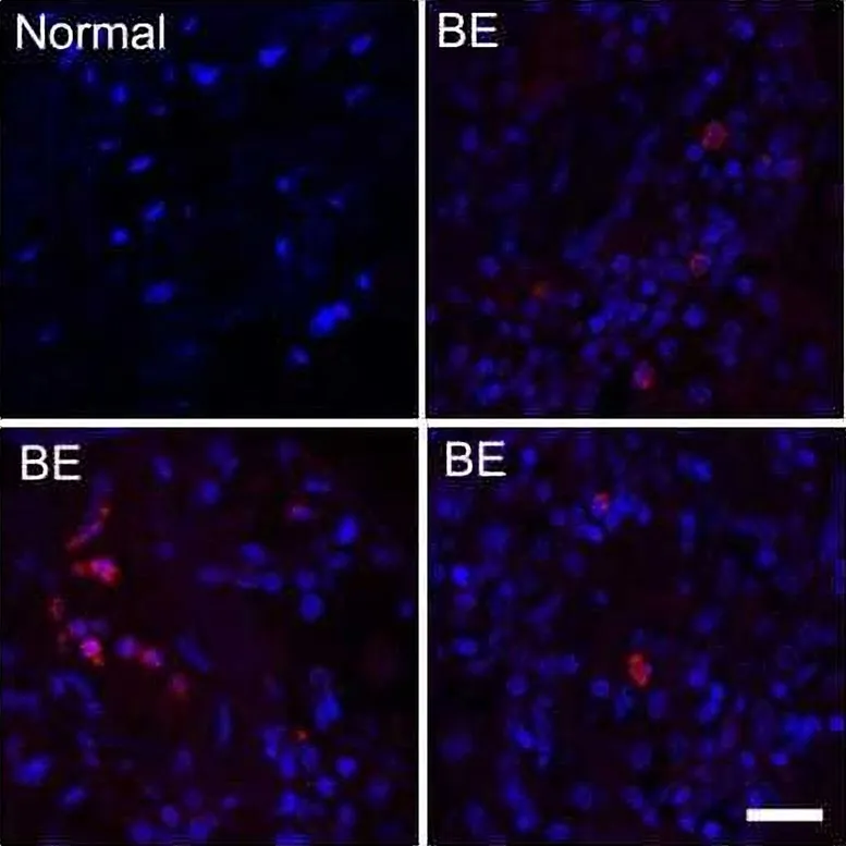 Neisseria-in-Lung-Tissue.webp