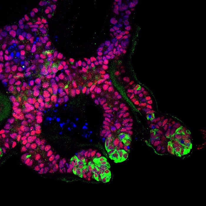 Human-Kidney-Ureteric-Bud-Organoids.jpg