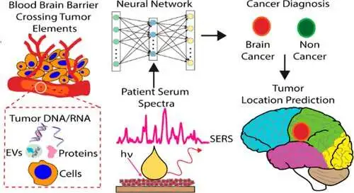 biosensor-detects-brai.webp