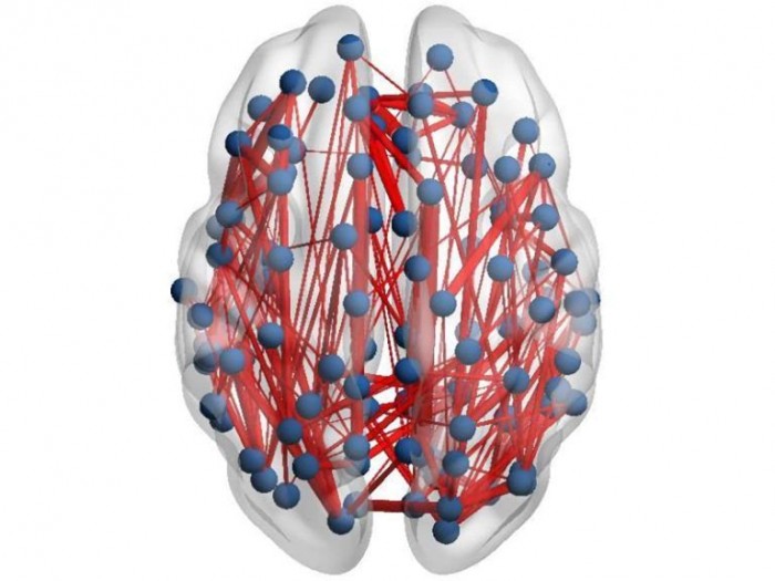 Depression-Brain-Connections-Map-768x576.jpg